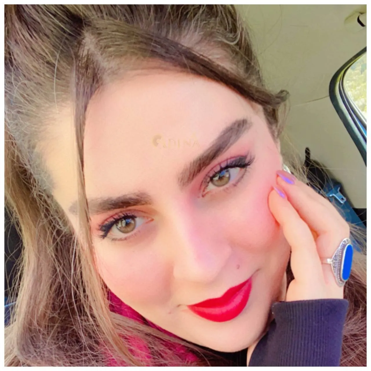 سه ماه بعد از کاشت ابرو